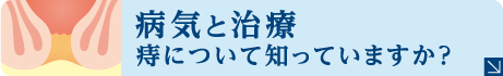 病気と治療 痔について知っていますか？